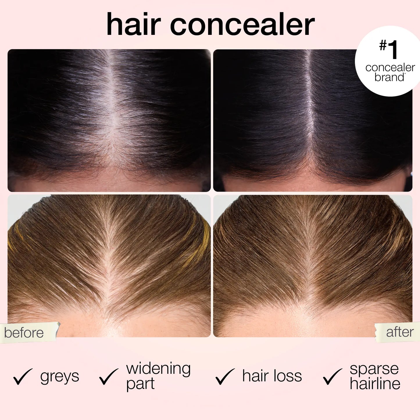 Covers greys, widening part, hair loss, sparse hairline