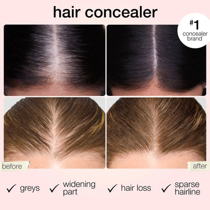 Covers greys, widening part, hair loss, sparse hairline