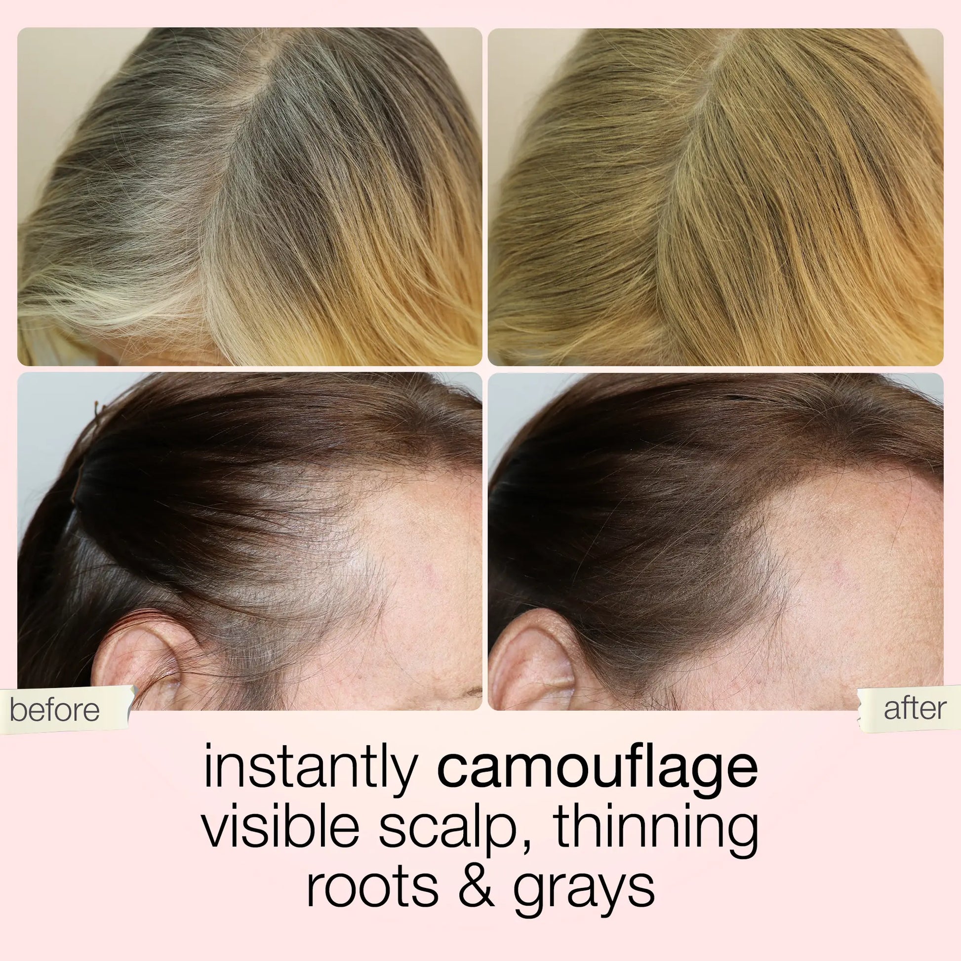 Camouflage visible scalp, thinning roots and grays
