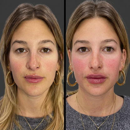 TrueLips Serum